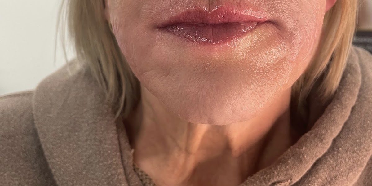 CVS Medical Aesthetics Weston