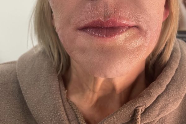CVS Medical Aesthetics Weston