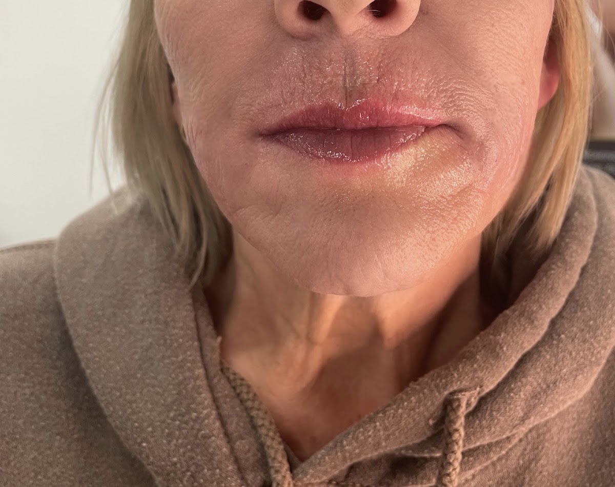 CVS Medical Aesthetics Weston
