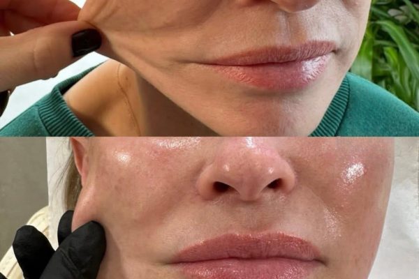 Chic Beauty Aesthetic