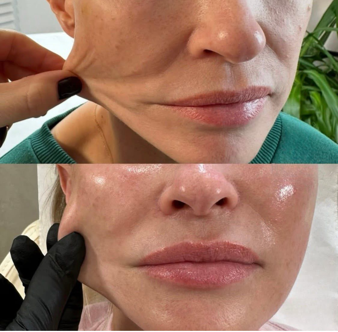 Chic Beauty Aesthetic