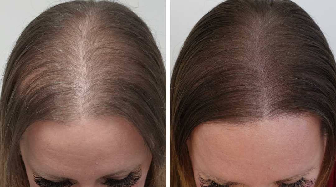 Micro Artistry Hair Clinic