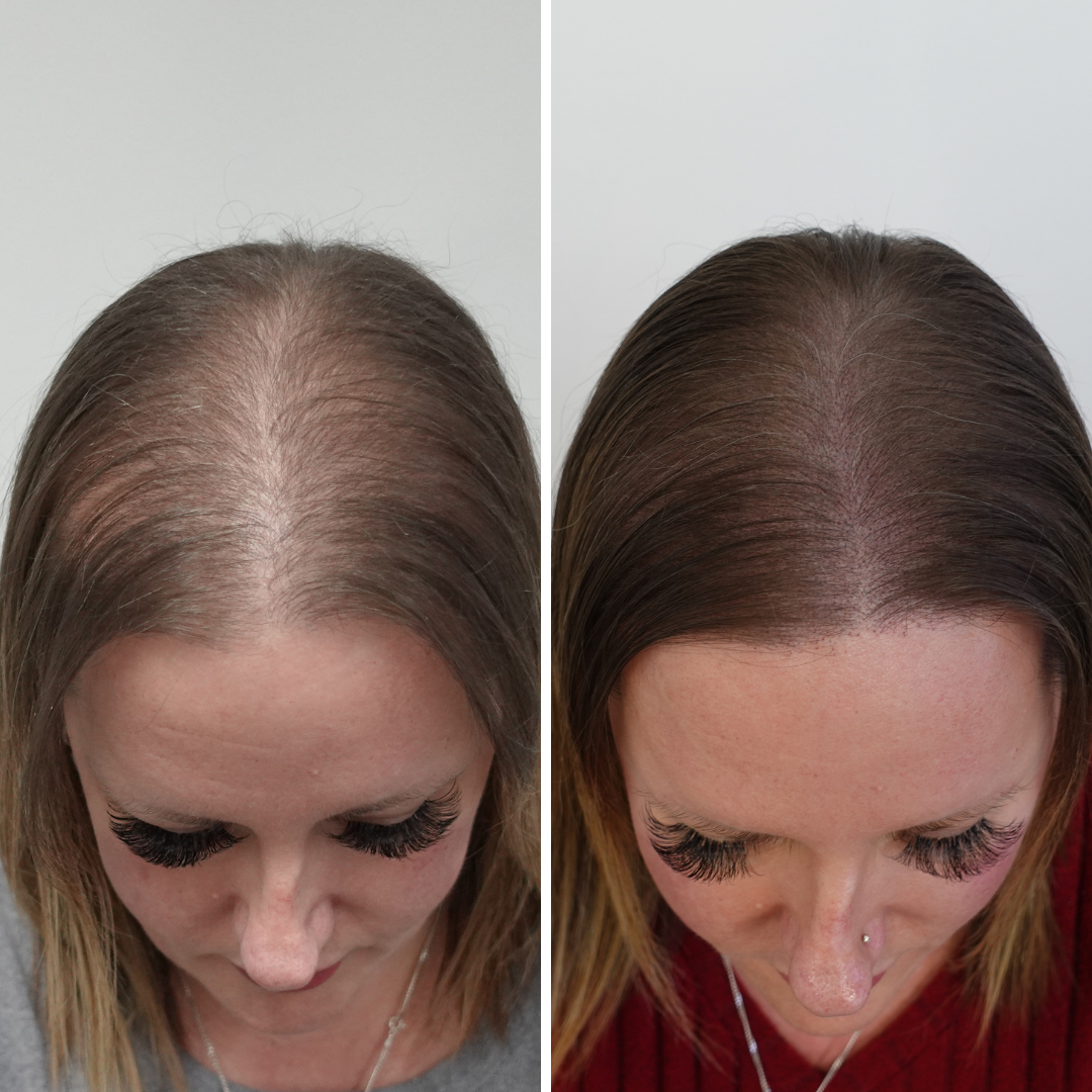 Micro Artistry Hair Clinic