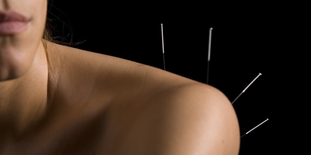 Winscombe Acupuncture