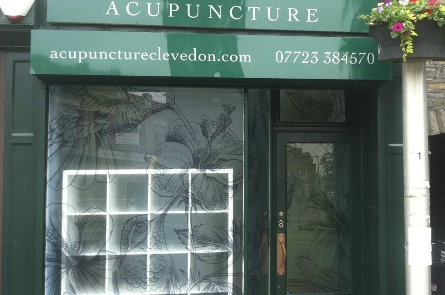 Greenfield Acupuncture
