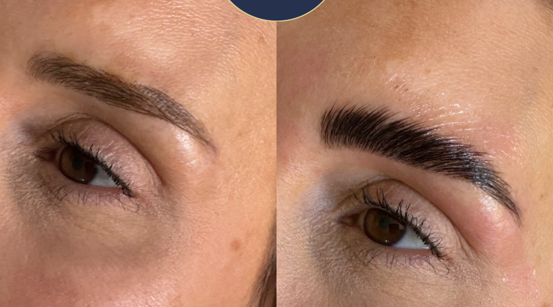 Weare Beauty & Skin Clinic