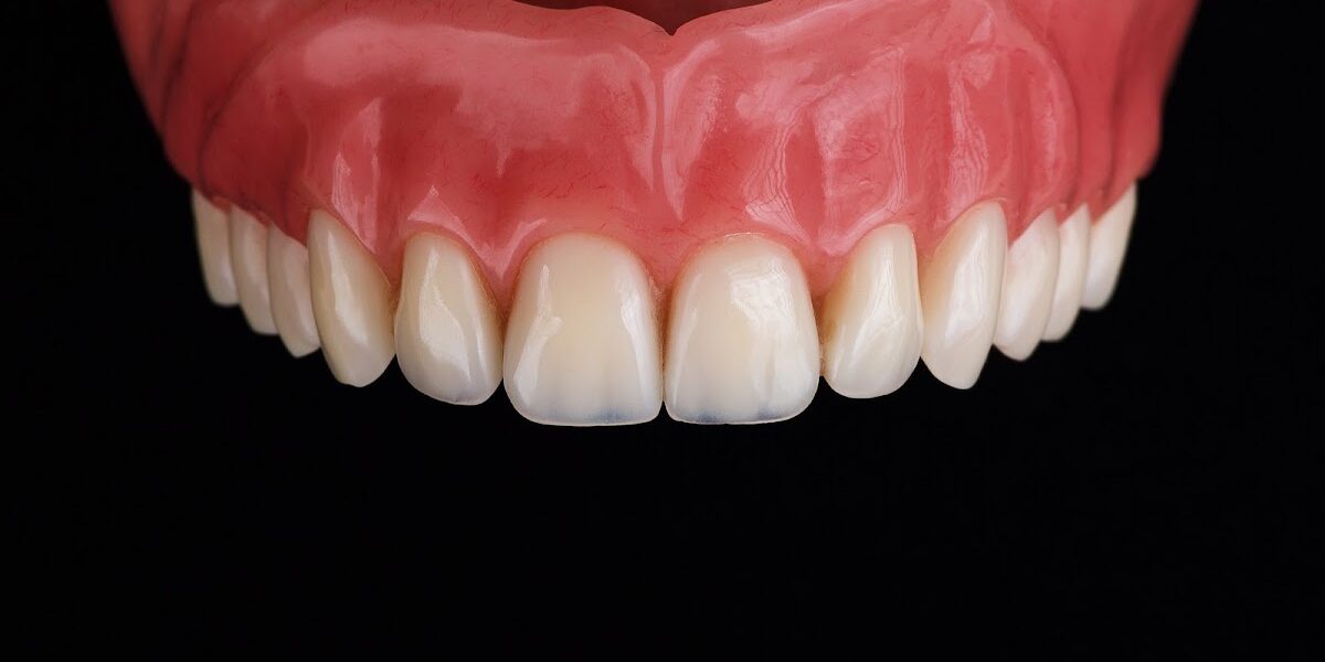 Denture repairs. Weston Dental Laboratory.